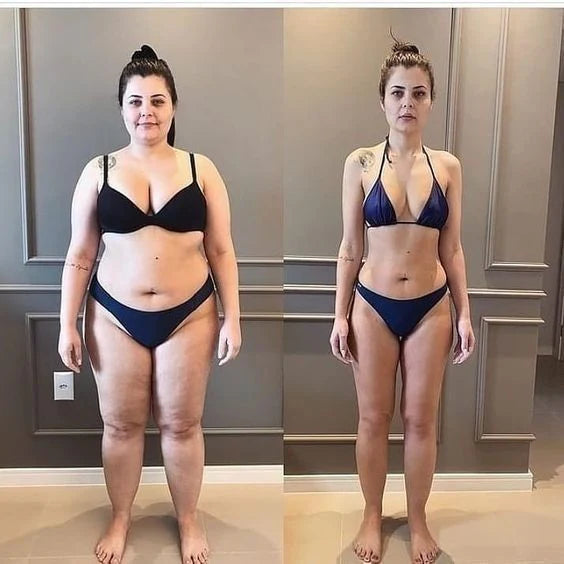 Patchs amincissants -8kg en 30 jours